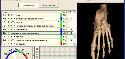 dubrov-4a1